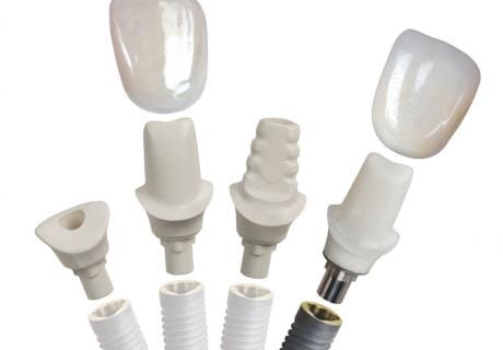 Maximizing Clinical Flexibility with the Open Platform Inclusive® Tooth Replacement System