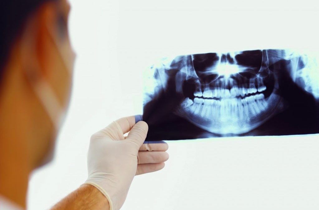 L’odontoiatra può svolgere l’attività radiodiagnostica complementare