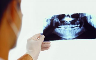 L’odontoiatra può svolgere l’attività radiodiagnostica complementare