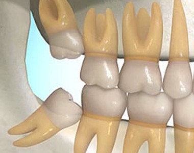 PERCHE I DENTI NON POSSONO E NON DEVONO RESTARE FERMI E ALLINEATI TUTTA LA VITA?