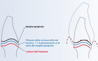 PRINCIPI DELLA TECNICA B.O.P.T (parte1)