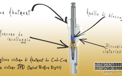 L’utilizzo di abutment e monconi non autentici ma compatibili.