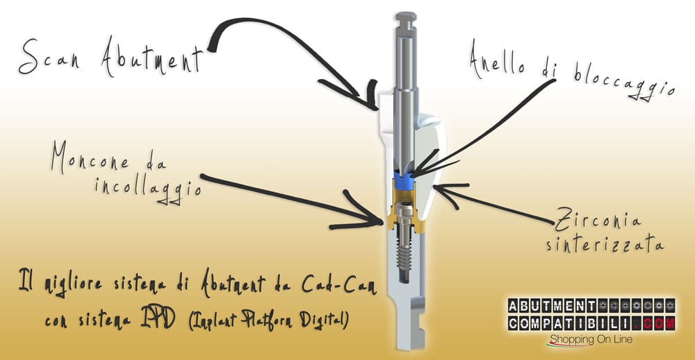 L’utilizzo di abutment e monconi non autentici ma compatibili.