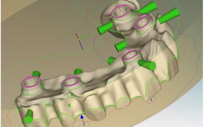 Finalmente abbiamo potuto mettere le mani sulla nuova versione del CAM Hyperdent V8.2